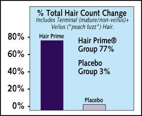 HAIRPRIME HAIR LOSS THINNING HAIR TREATMENTS